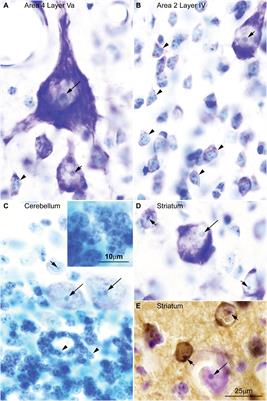 Parallel Development of Chromatin Patterns, Neuron Morphology, and Connections: Potential for Disruption in Autism